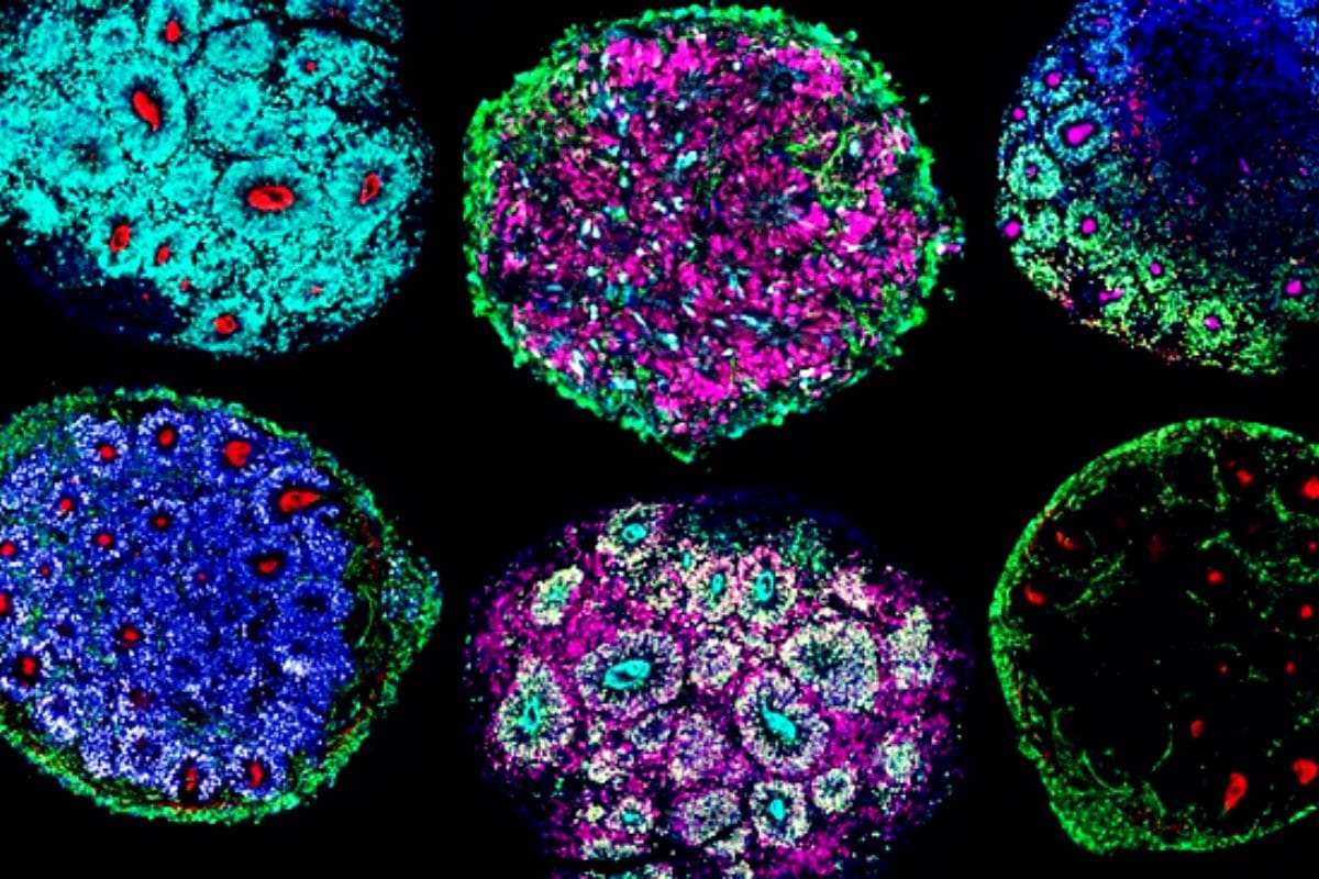 Minicerebros creados por científicos por primera vez con células distintas