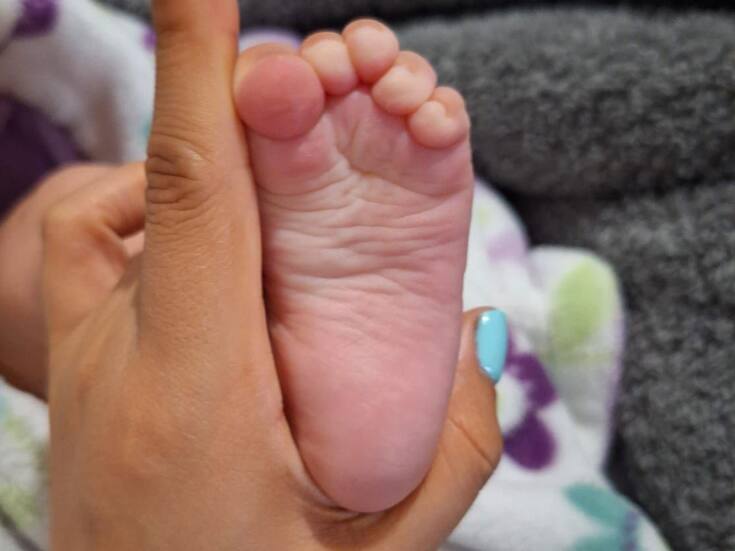 Importante realizar tamiz neonatal en recién nacidos