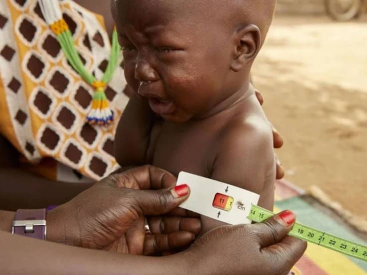 ONU exige medidas urgentes ante desnutrición infantil en Sudán