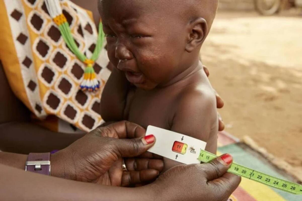 ONU exige medidas urgentes ante desnutrición infantil en Sudán