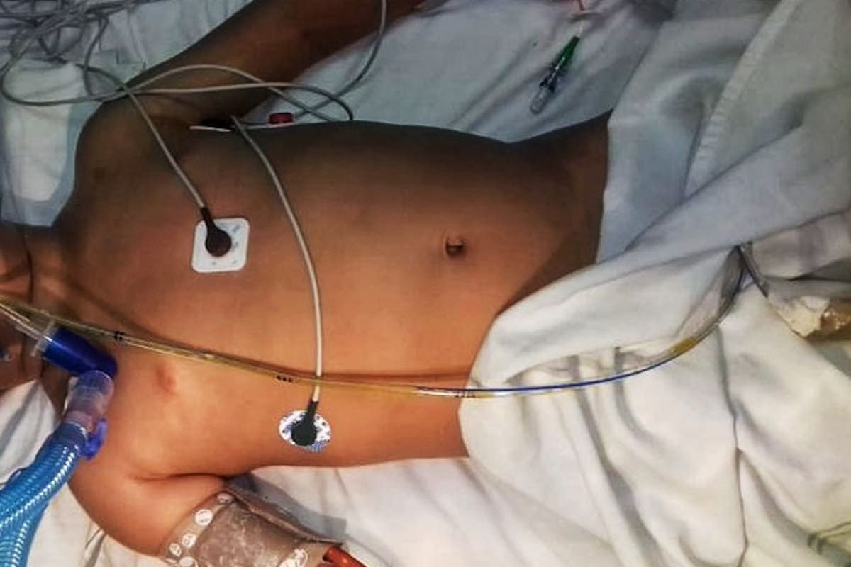 Niño ahogado en alberca, grave en hospital