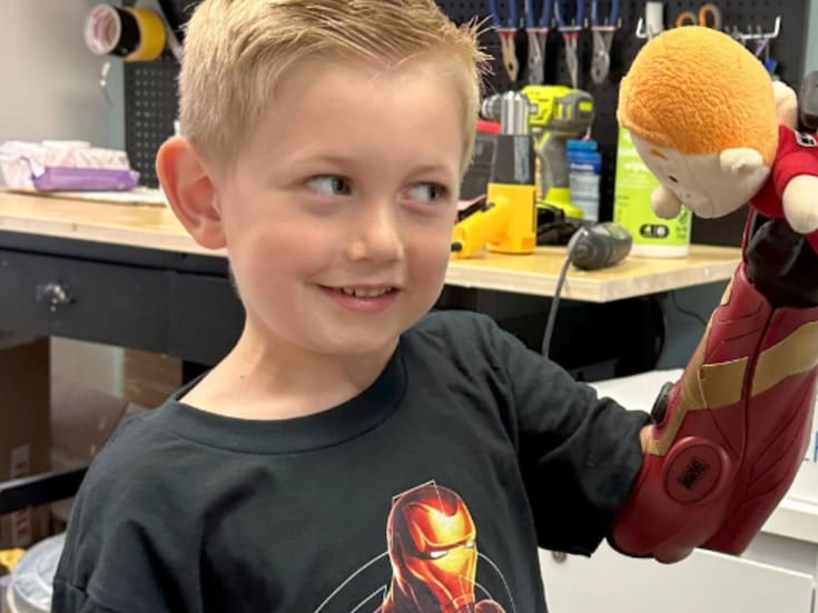 Niño de 5 años recibe un brazo biónico al estilo Iron Man 